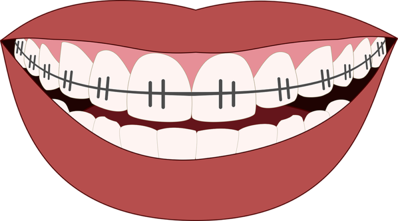 traitement orthodontique