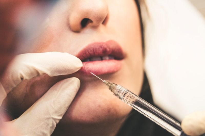 injection acide hyaluronique