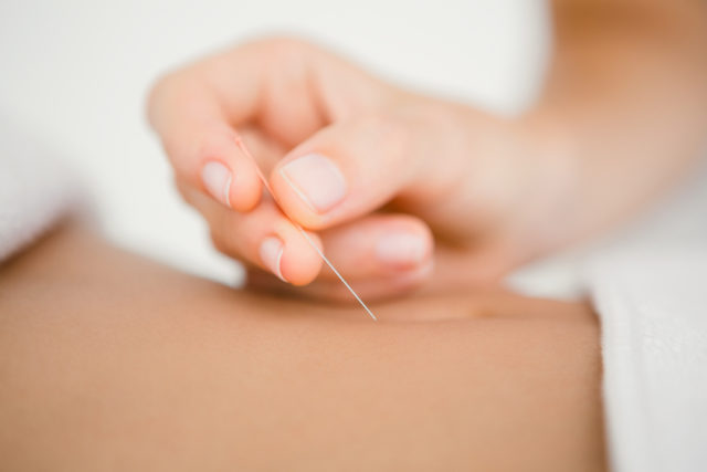 acupuncture et bien-être