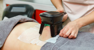 coolsculpting