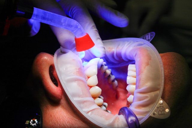 traitements des orthodontistes