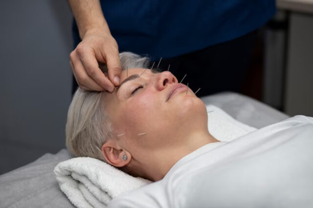 vêtement acupuncture