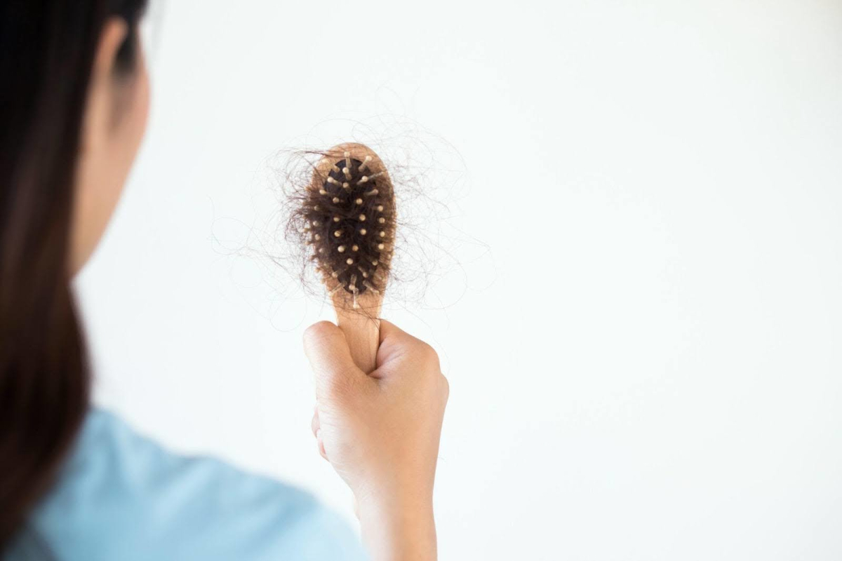 chute de cheveux