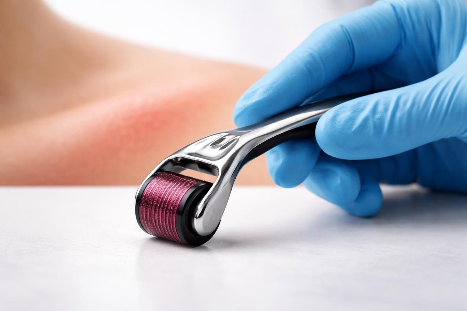 découvrez les dangers réels et les mythes autour du derma roller pour une utilisation sûre et éclairée. informez-vous avant d'adopter cette technique de soin de la peau.